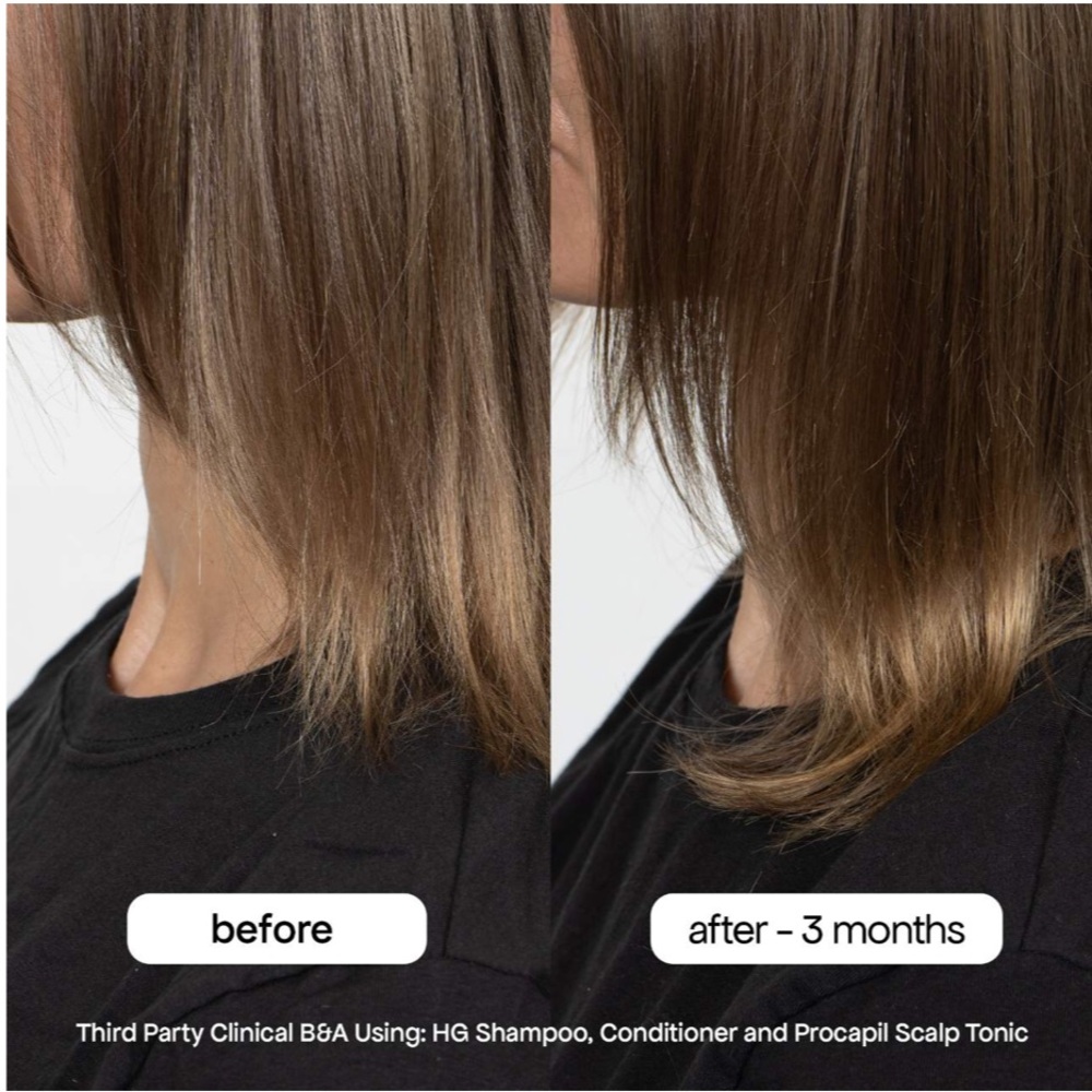 Bondi Boost HG Shampoo - White Label, Nourishing Hair Cleanse - Picture 2 of 7